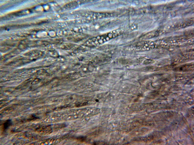 Amanita ceciliae 10 - Subpellis agua 2